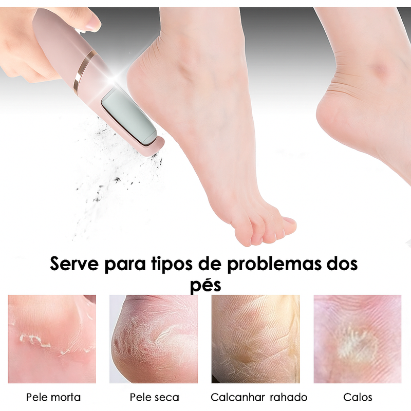 Lukton® Lixador Elétrico Premium – Adeus Calos e Pés Rachados