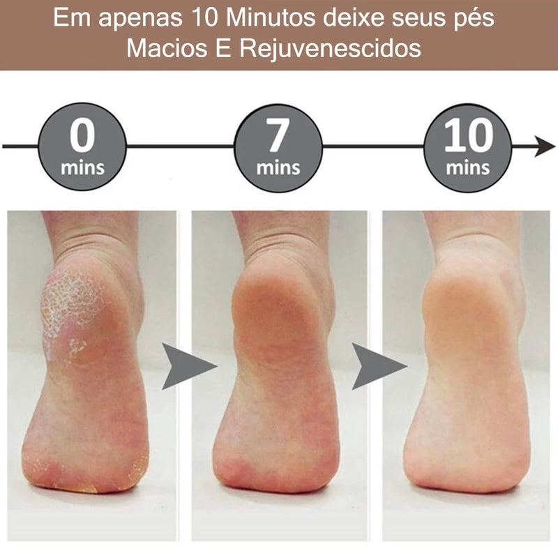 Lukton® Lixador Elétrico Premium – Adeus Calos e Pés Rachados
