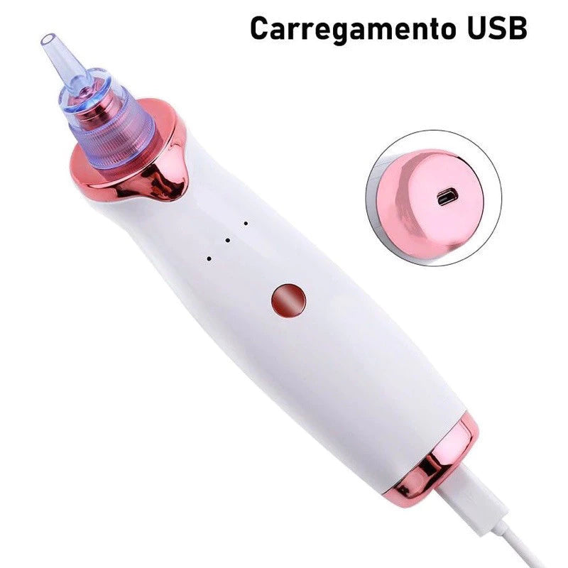 ClearSkin Pro™ – Removedor de Cravos e Espinhas Recarregável a Vácuo | Sucção Potente e Resultado Imediato