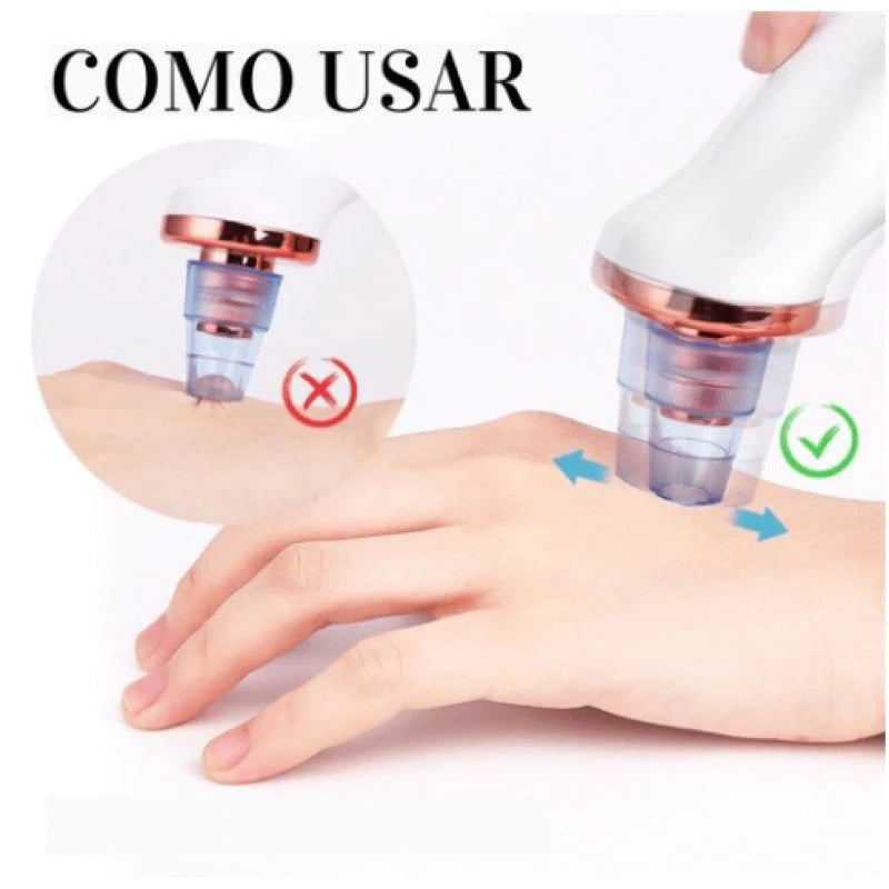 ClearSkin Pro™ – Removedor de Cravos e Espinhas Recarregável a Vácuo | Sucção Potente e Resultado Imediato