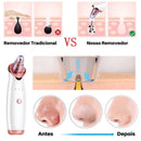 Removedor de Cravos e Espinhas Recarregável a Vácuo  Sucção Potente e Resultado Imediato – ClearSkin Pro™