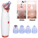 Removedor de Cravos e Espinhas Recarregável a Vácuo  Sucção Potente e Resultado Imediato – ClearSkin Pro™