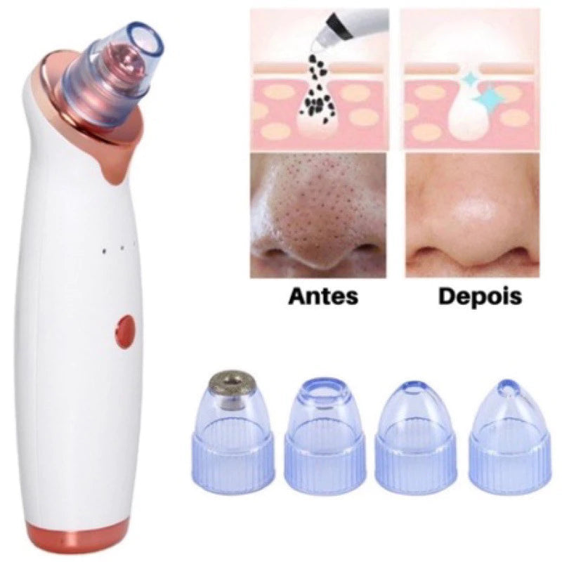 ClearSkin Pro™ – Removedor de Cravos e Espinhas Recarregável a Vácuo | Sucção Potente e Resultado Imediato